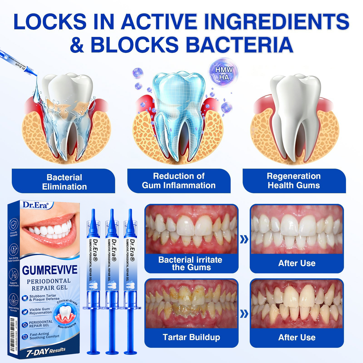 🏅🦷𝐎𝐟𝐟𝐢𝐜𝐢𝐚𝐥 𝐒𝐭𝐨𝐫𝐞 | 𝐃𝐫.𝐄𝐫𝐚® 𝐆𝐮𝐦𝐑𝐞𝐯𝐢𝐯𝐞 𝐏𝐞𝐫𝐢𝐨𝐝𝐨𝐧𝐭𝐚𝐥 𝐑𝐞𝐩𝐚𝐢𝐫 𝐆𝐞𝐥 — 𝐓𝐚𝐫𝐠𝐞𝐭𝐞𝐝 𝐆𝐮𝐦𝐥𝐢𝐧𝐞 𝐒𝐮𝐩𝐩𝐨𝐫𝐭 𝐟𝐨𝐫 𝐏𝐥𝐚𝐪𝐮𝐞, 𝐂𝐚𝐯𝐢𝐭𝐢𝐞𝐬, 𝐏𝐞𝐫𝐢𝐨𝐝𝐨𝐧𝐭𝐚𝐥 𝐂𝐨𝐧𝐜𝐞𝐫𝐧𝐬, 𝐁𝐚𝐝 𝐁𝐫𝐞𝐚𝐭𝐡 & 𝐖𝐞𝐚𝐤 𝐓𝐞𝐞𝐭𝐡 | 𝐏𝐫𝐞𝐜𝐢𝐬𝐢𝐨𝐧 𝐋𝐞𝐚𝐯𝐞-𝐎𝐧 𝐎𝐫𝐚𝐥 𝐂𝐚𝐫𝐞 𝐅𝐨𝐫𝐦𝐮𝐥𝐚