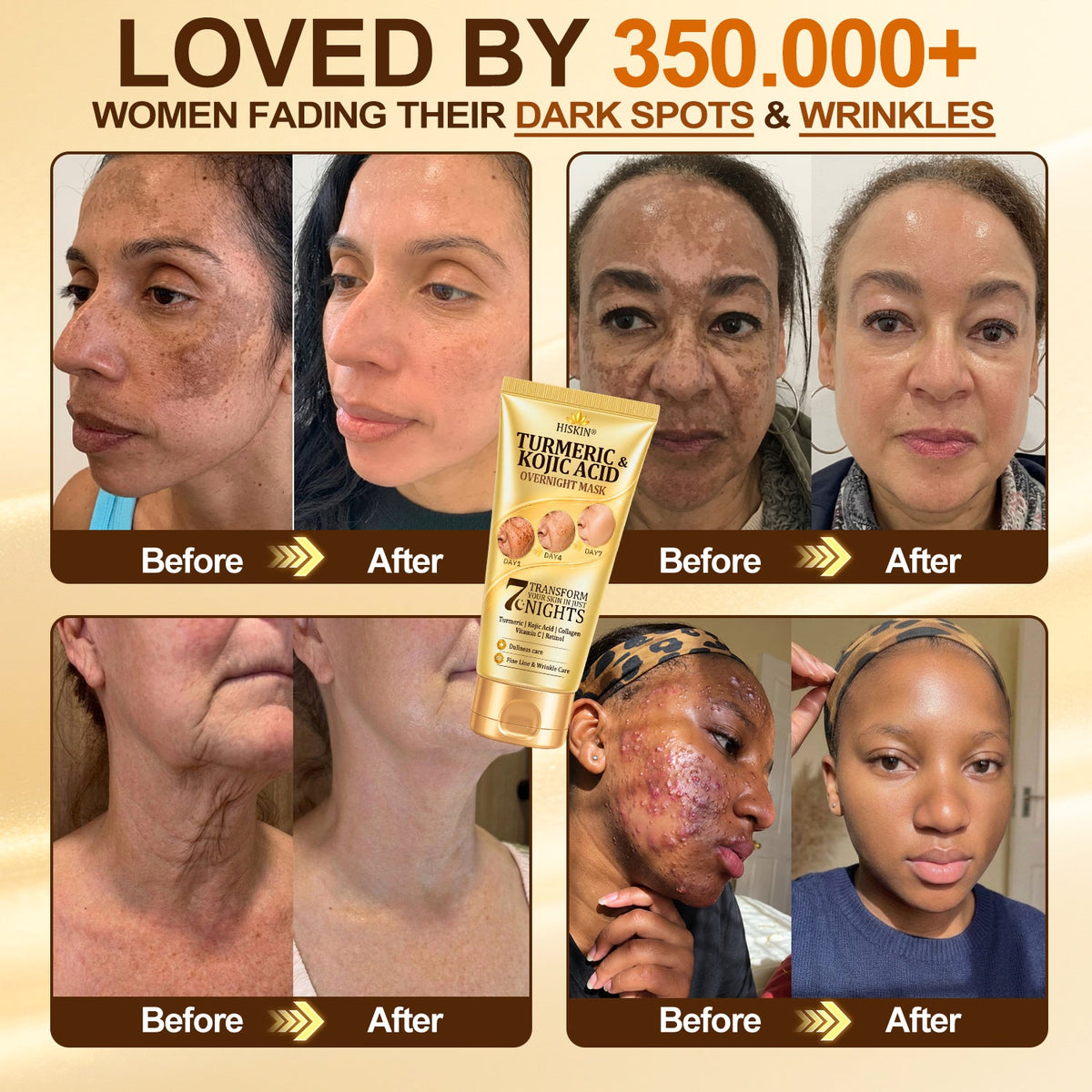 ⏰ Your exclusive Hiskin® discount is active! Today only: save an extra 50% on the Turmeric × Kojic Acid × Peptides Overnight Peel-Off Mask—secure yours now before this offer ends! ✅