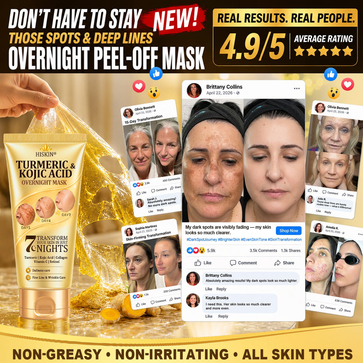 𝑶𝒇𝒇𝒊𝒄𝒊𝒂𝒍 𝑺𝒕𝒐𝒓𝒆 | 𝐍𝐞𝐰! ✨ 𝐇𝐢𝐬𝐤𝐢𝐧® 𝐓𝐮𝐫𝐦𝐞𝐫𝐢𝐜 × 𝐊𝐨𝐣𝐢𝐜 𝐀𝐜𝐢𝐝 𝐎𝐯𝐞𝐫𝐧𝐢𝐠𝐡𝐭 𝐏𝐞𝐞𝐥-𝐎𝐟𝐟 𝐌𝐚𝐬𝐤 — 𝐅𝐚𝐝𝐞 𝐒𝐭𝐮𝐛𝐛𝐨𝐫𝐧 𝐃𝐚𝐫𝐤 𝐒𝐩𝐨𝐭𝐬 & 𝐒𝐦𝐨𝐨𝐭𝐡 𝐕𝐢𝐬𝐢𝐛𝐥𝐞 𝐖𝐫𝐢𝐧𝐤𝐥𝐞𝐬 𝐖𝐡𝐢𝐥𝐞 𝐘𝐨𝐮 𝐒𝐥𝐞𝐞𝐩 🌙✨ 𝐓𝐮𝐫𝐦𝐞𝐫𝐢𝐜 × 𝐊𝐨𝐣𝐢𝐜 𝐀𝐜𝐢𝐝 × 𝐏𝐞𝐩𝐭𝐢𝐝𝐞𝐬 ✅ 𝐎𝐧𝐞 𝐒𝐭𝐞𝐩 𝐚 𝐍𝐢𝐠𝐡𝐭 · 𝐕𝐢𝐬𝐢𝐛𝐥𝐞 𝐂𝐡𝐚𝐧𝐠𝐞𝐬 𝐢𝐧 𝟕 𝐍𝐢𝐠𝐡𝐭𝐬 💯