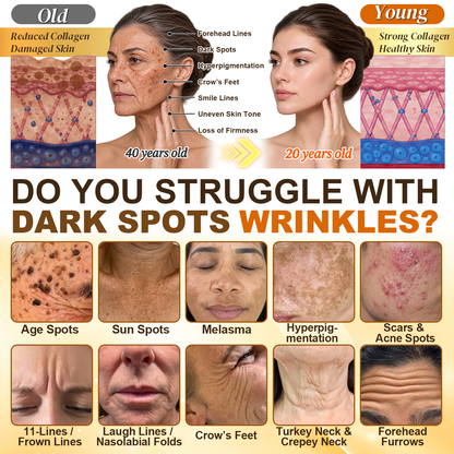 ⏰ Your exclusive Hiskin® discount is active! Today only: save an extra 50% on the Turmeric × Kojic Acid × Peptides Overnight Peel-Off Mask—secure yours now before this offer ends! ✅
