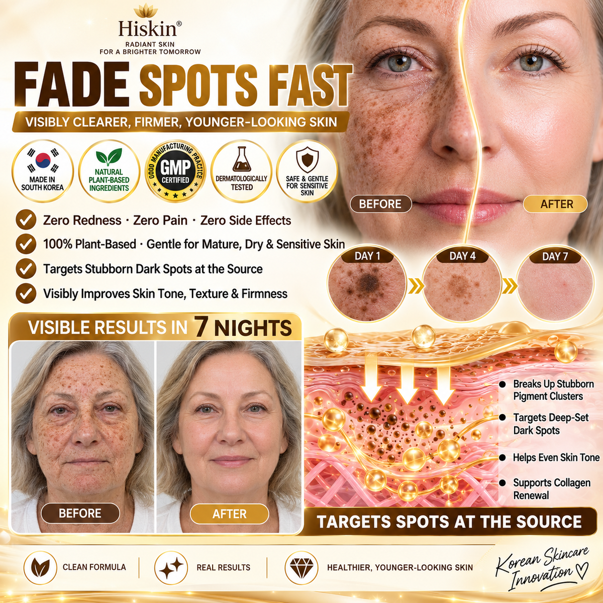 𝑶𝒇𝒇𝒊𝒄𝒊𝒂𝒍 𝑺𝒕𝒐𝒓𝒆 | 𝐍𝐞𝐰! ✨ 𝐇𝐢𝐬𝐤𝐢𝐧® 𝐓𝐮𝐫𝐦𝐞𝐫𝐢𝐜 × 𝐊𝐨𝐣𝐢𝐜 𝐀𝐜𝐢𝐝 𝐎𝐯𝐞𝐫𝐧𝐢𝐠𝐡𝐭 𝐏𝐞𝐞𝐥-𝐎𝐟𝐟 𝐌𝐚𝐬𝐤 — 𝐅𝐚𝐝𝐞 𝐒𝐭𝐮𝐛𝐛𝐨𝐫𝐧 𝐃𝐚𝐫𝐤 𝐒𝐩𝐨𝐭𝐬 & 𝐒𝐦𝐨𝐨𝐭𝐡 𝐕𝐢𝐬𝐢𝐛𝐥𝐞 𝐖𝐫𝐢𝐧𝐤𝐥𝐞𝐬 𝐖𝐡𝐢𝐥𝐞 𝐘𝐨𝐮 𝐒𝐥𝐞𝐞𝐩 🌙✨ 𝐓𝐮𝐫𝐦𝐞𝐫𝐢𝐜 × 𝐊𝐨𝐣𝐢𝐜 𝐀𝐜𝐢𝐝 × 𝐏𝐞𝐩𝐭𝐢𝐝𝐞𝐬 ✅ 𝐎𝐧𝐞 𝐒𝐭𝐞𝐩 𝐚 𝐍𝐢𝐠𝐡𝐭 · 𝐕𝐢𝐬𝐢𝐛𝐥𝐞 𝐂𝐡𝐚𝐧𝐠𝐞𝐬 𝐢𝐧 𝟕 𝐍𝐢𝐠𝐡𝐭𝐬 💯