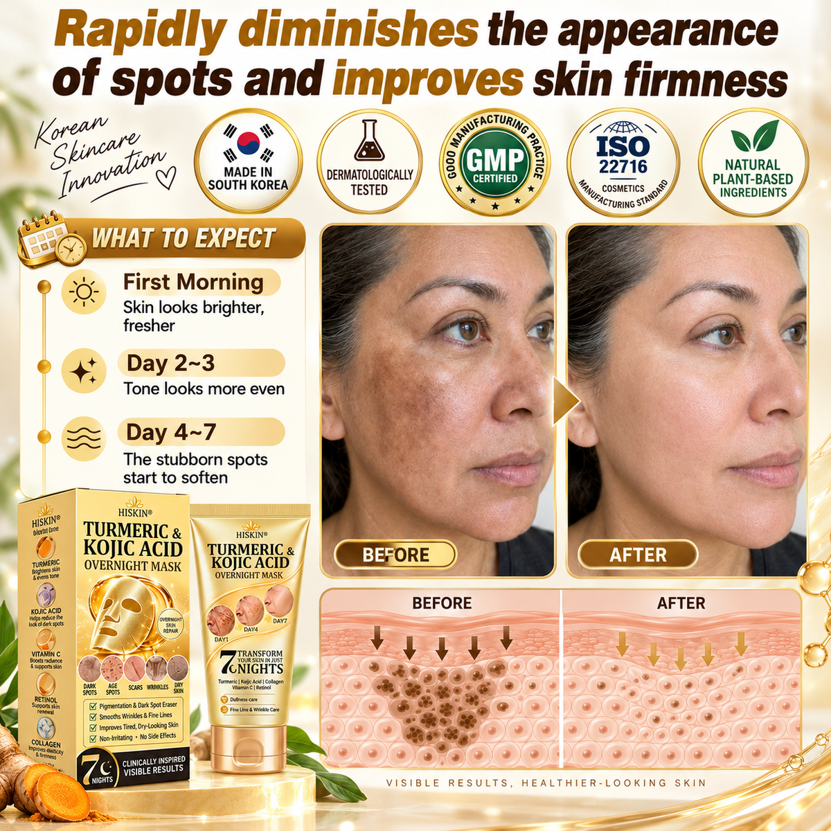 𝑶𝒇𝒇𝒊𝒄𝒊𝒂𝒍 𝑺𝒕𝒐𝒓𝒆 | 𝐍𝐞𝐰! ✨ 𝐇𝐢𝐬𝐤𝐢𝐧® 𝐓𝐮𝐫𝐦𝐞𝐫𝐢𝐜 × 𝐊𝐨𝐣𝐢𝐜 𝐀𝐜𝐢𝐝 𝐎𝐯𝐞𝐫𝐧𝐢𝐠𝐡𝐭 𝐏𝐞𝐞𝐥-𝐎𝐟𝐟 𝐌𝐚𝐬𝐤 — 𝐅𝐚𝐝𝐞 𝐒𝐭𝐮𝐛𝐛𝐨𝐫𝐧 𝐃𝐚𝐫𝐤 𝐒𝐩𝐨𝐭𝐬 & 𝐒𝐦𝐨𝐨𝐭𝐡 𝐕𝐢𝐬𝐢𝐛𝐥𝐞 𝐖𝐫𝐢𝐧𝐤𝐥𝐞𝐬 𝐖𝐡𝐢𝐥𝐞 𝐘𝐨𝐮 𝐒𝐥𝐞𝐞𝐩 🌙✨ 𝐓𝐮𝐫𝐦𝐞𝐫𝐢𝐜 × 𝐊𝐨𝐣𝐢𝐜 𝐀𝐜𝐢𝐝 × 𝐏𝐞𝐩𝐭𝐢𝐝𝐞𝐬 ✅ 𝐎𝐧𝐞 𝐒𝐭𝐞𝐩 𝐚 𝐍𝐢𝐠𝐡𝐭 · 𝐕𝐢𝐬𝐢𝐛𝐥𝐞 𝐂𝐡𝐚𝐧𝐠𝐞𝐬 𝐢𝐧 𝟕 𝐍𝐢𝐠𝐡𝐭𝐬 💯
