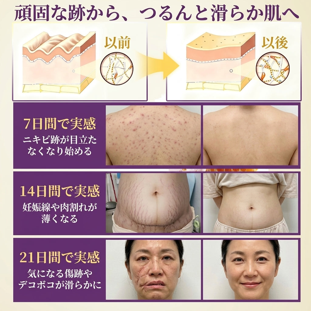 日本製・国内発送✨ 𝐆𝐎𝐋𝐃𝐊𝐈𝐒𝐒® 𝐆𝐇𝐊-𝐂𝐮 & 𝐁𝐈𝐎𝐓𝐈𝐍 𝟏𝟎-𝐈𝐍-𝟏「ゴールドキッス ® GHK-Cu ＆ ビオチン 10-in-1」スキンリストアクリーム⚡贅沢な美容成分が 1 つに凝縮！！
