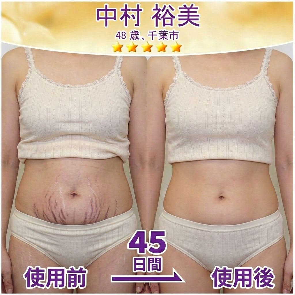 日本製・国内発送✨ 𝐆𝐎𝐋𝐃𝐊𝐈𝐒𝐒® 𝐆𝐇𝐊-𝐂𝐮 & 𝐁𝐈𝐎𝐓𝐈𝐍 𝟏𝟎-𝐈𝐍-𝟏「ゴールドキッス ® GHK-Cu ＆ ビオチン 10-in-1」スキンリストアクリーム⚡贅沢な美容成分が 1 つに凝縮！！