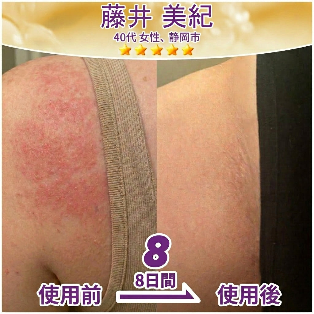 日本製・国内発送✨ 𝐆𝐎𝐋𝐃𝐊𝐈𝐒𝐒® 𝐆𝐇𝐊-𝐂𝐮 & 𝐁𝐈𝐎𝐓𝐈𝐍 𝟏𝟎-𝐈𝐍-𝟏「ゴールドキッス ® GHK-Cu ＆ ビオチン 10-in-1」スキンリストアクリーム⚡贅沢な美容成分が 1 つに凝縮！！