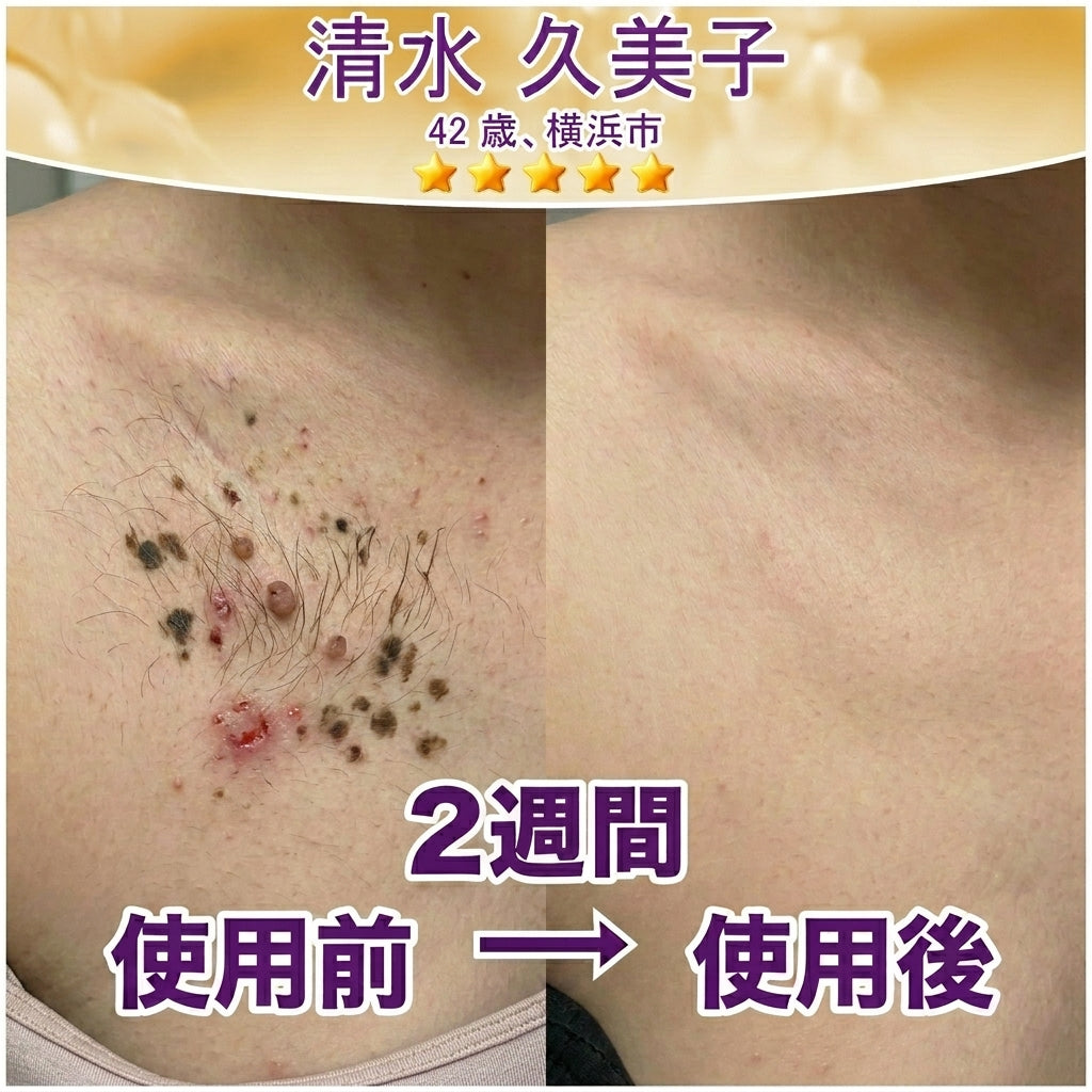 日本製・国内発送✨ 𝐆𝐎𝐋𝐃𝐊𝐈𝐒𝐒® 𝐆𝐇𝐊-𝐂𝐮 & 𝐁𝐈𝐎𝐓𝐈𝐍 𝟏𝟎-𝐈𝐍-𝟏「ゴールドキッス ® GHK-Cu ＆ ビオチン 10-in-1」スキンリストアクリーム⚡贅沢な美容成分が 1 つに凝縮！！